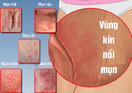 1734535888744481.png vung-kin-noi-mun.png