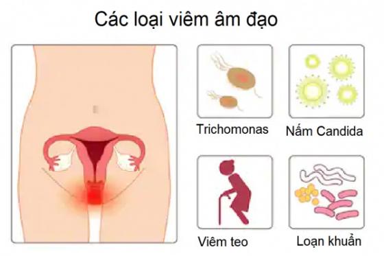1734536415645496.jpg cac-loai-viem-am-dao.jpg